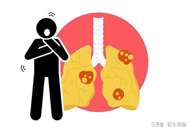 长期吸烟，谨防肺部病变！身体出现6个异常，或是肺发出的求救信 - 1