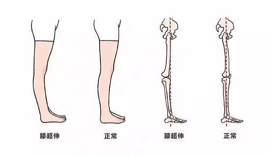 腿长1米8无修图？！看了世界最长腿，发现她们是真敢说... - 31