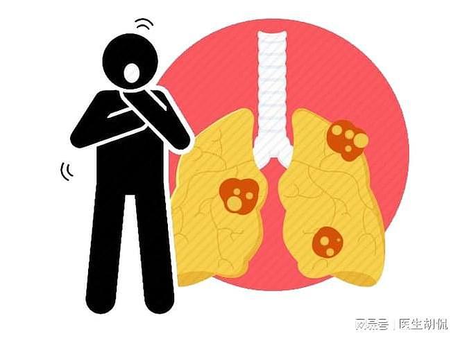 咳嗽变异性哮喘是怎么引起的？大多与这4大因素有关，希望你重视 - 1