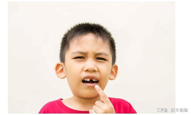 孩子换牙期不可自行拔牙？当孩子处在换牙期，4点爸妈可得要了解 - 1