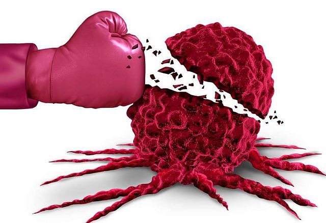 HPV病毒会“伪装”，不检查很难发现，若出现4种特征，建议早筛查 - 6