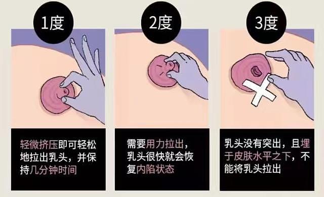 乳腺溢液的5种类型，一经发现，不容小觑 - 4