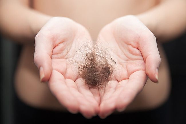 如何预防脱发？这4个习惯，不是靠一天两天就能养成的 - 1