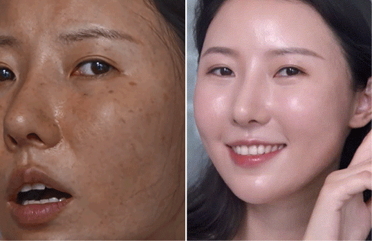 皮肤科医生揭秘：药店有一种擦脸的，16天淡色斑，可惜很少人知道！ - 26