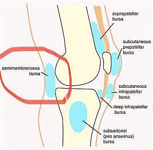 医学专家分析詹皇膝伤两种情况：贝克氏囊肿概率小，老詹心里有数 - 4