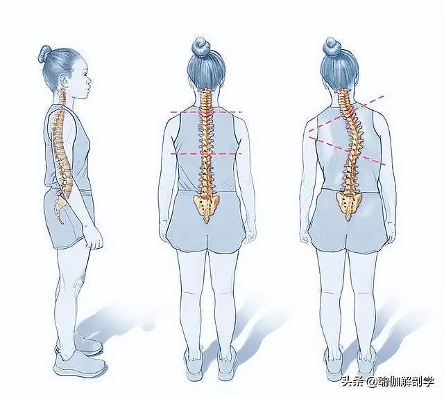 1 套脊柱调理瑜伽，缓解腰酸背疼，让脊柱更年轻 - 1