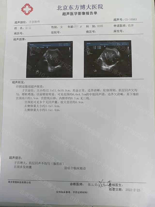上海巨大型子宫的腺肌症患者在北京顺利保宫 - 1