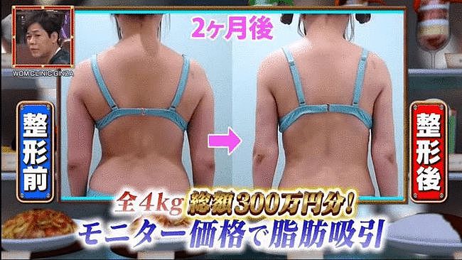 日本女偶像狂砸近50万全身整容，40岁少妇变美少女，前后判若两人 - 7