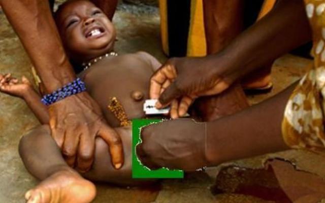 毒害全球2亿女性的割礼，切除女性器官，引发不孕难产的悲剧 - 2