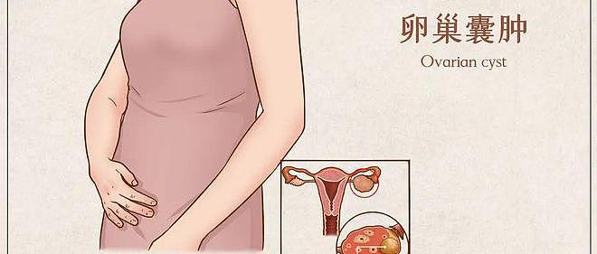 女人抗老得从调理卵巢囊肿开始，这几点你做到了吗？ - 4