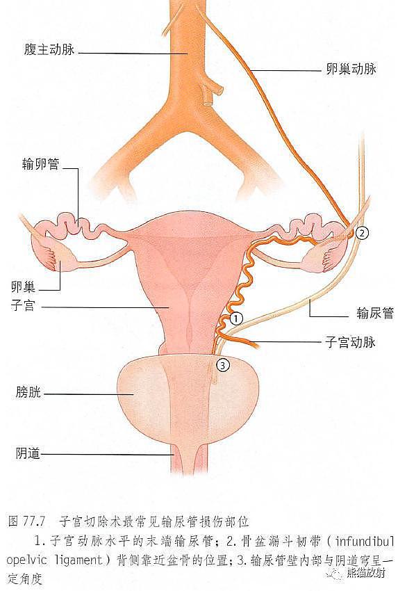解剖丨膀胱、前列腺、尿道、生殖系统 - 23