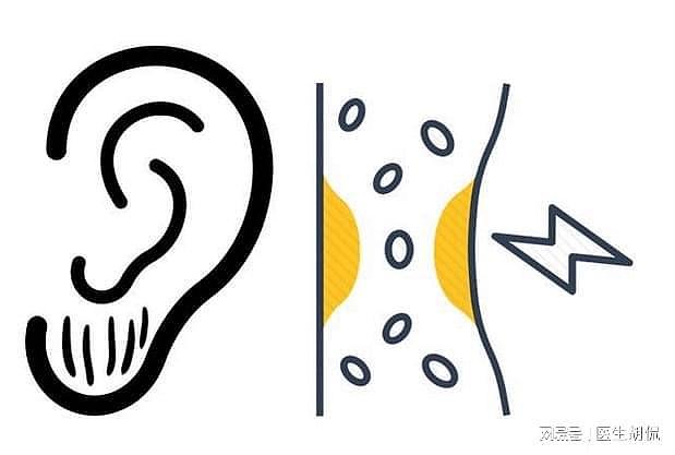 长期戴耳机睡觉致左耳失聪？一个坏行为，让年轻人成了“小聋人” - 5