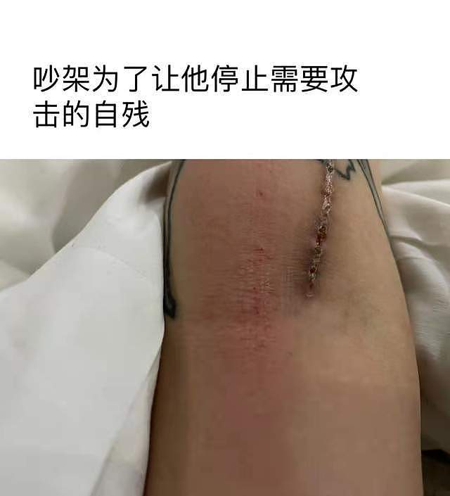 网红殷世航被曝殴打前女友！掐脖子撞墙拿脚踹，还被控出轨太混乱 - 8