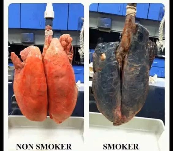 3 包烟就能熏黑一个肺！看过这组实验，再也没人抽了 - 7
