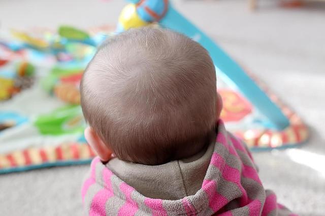 宝宝健康与否，从头发上也能看出一二，出现以下特征或身体有问题 - 4