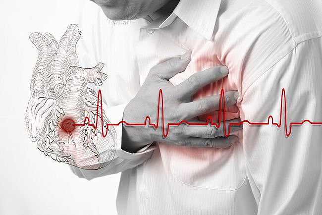 胸痛是哪些原因导致的？不同情况下该怎么处理？分类让您清楚 - 2