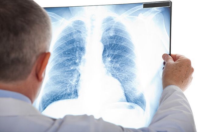 检查结果显示“肺部有阴影”，这是怎么回事？有这7种可能性 - 1