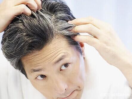 经常染发会导致白发越来越多？染发只针对头发的，白发是身体原因 - 4