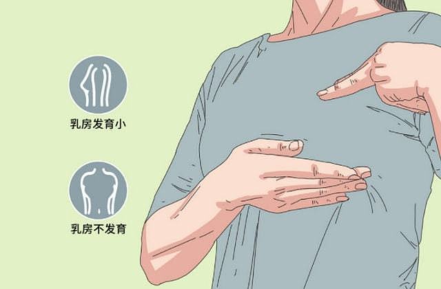波兰式综合征是一种先天性疾病，表现在胸和手部，严重者可手术 - 1
