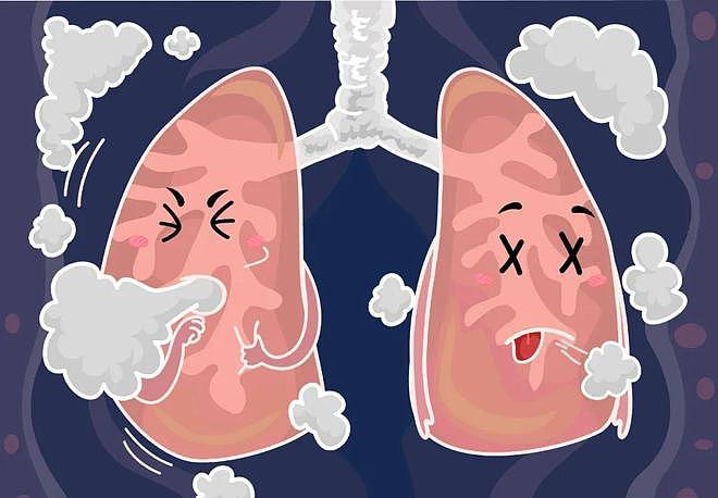 哮喘发作反复，如何进行科学防治？3点基础知识应当牢记 - 1
