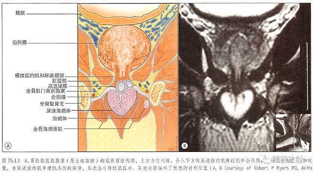 解剖丨膀胱、前列腺、尿道、生殖系统 - 9