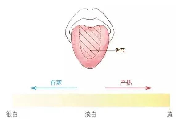 简单实用的舌诊图谱大全，一看就懂，教你快速识别疾病！ - 4