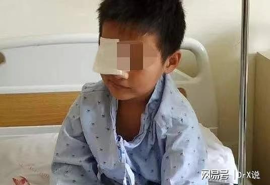 福州10岁男童几乎失明，只因家长天天亲手帮他滴眼药水！ - 1
