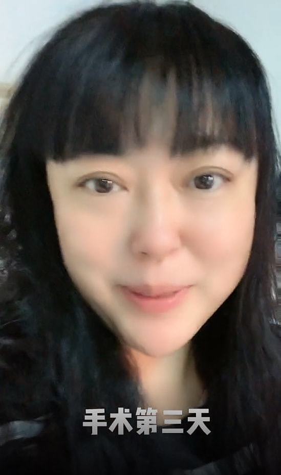 51岁李菁菁自曝患癌，晒术后照面容消瘦，深情表白孩子和90后老公 - 2