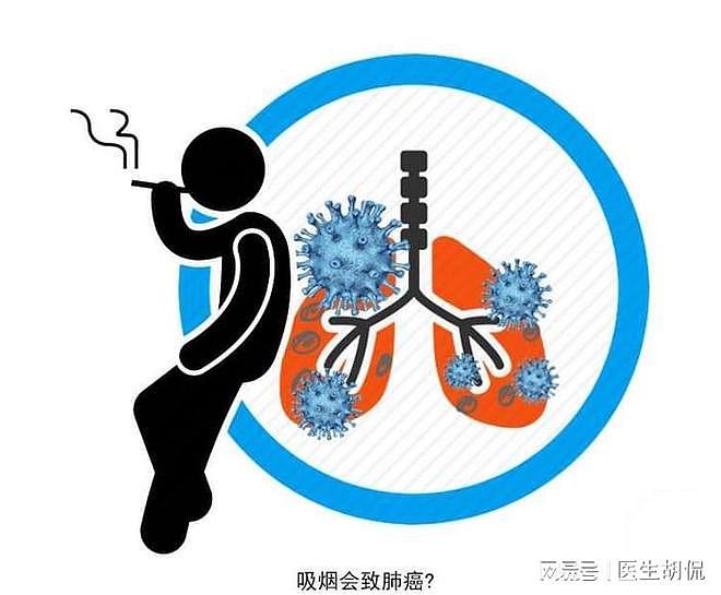 “肺癌”患者为何增多？医生告知：4件事若能避开，能预防肺病 - 2