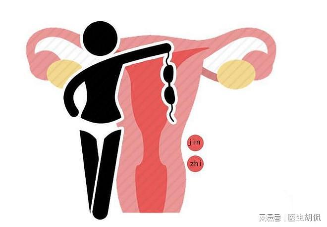女子漏尿57年!女性尿失禁，不妨多做3个运动，有助于缓解尴尬 - 4