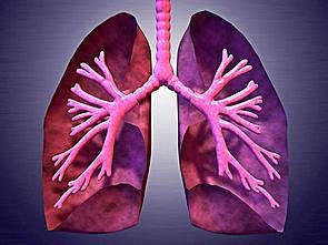 肺纤维化病人连续增长，应该如何预防？ - 2