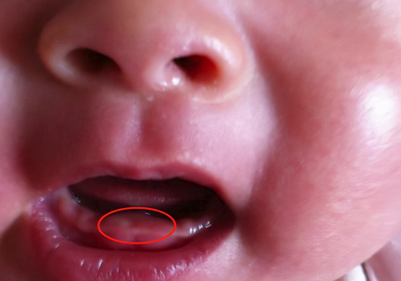 宝宝究竟多大长牙才算正常？宝妈对照“出牙顺序表”就心理有数了 - 2