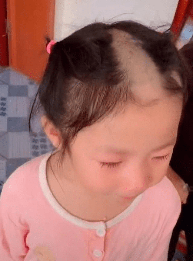5岁女儿偷玩理发器，剃头后秒变“谢广坤”，网友：忍不住笑出声 - 2