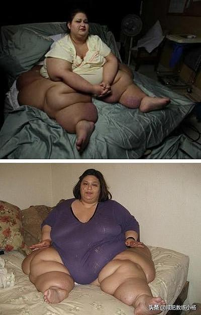 最胖的10位胖子有多重？个个都成饼了，脂肪增长到底有没有上限