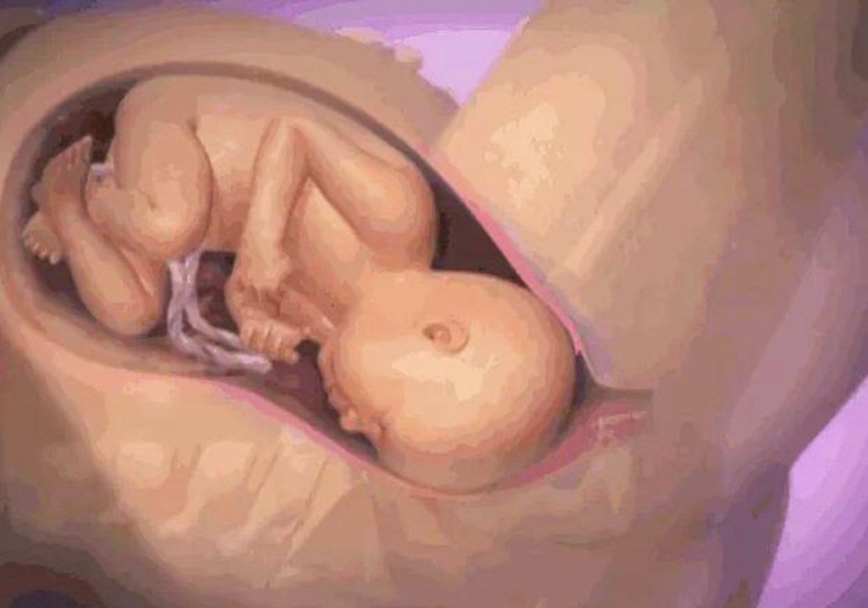 宝宝出生全身“发青”，医生：羊水浑浊惹的祸，和孕期习惯有关 - 3