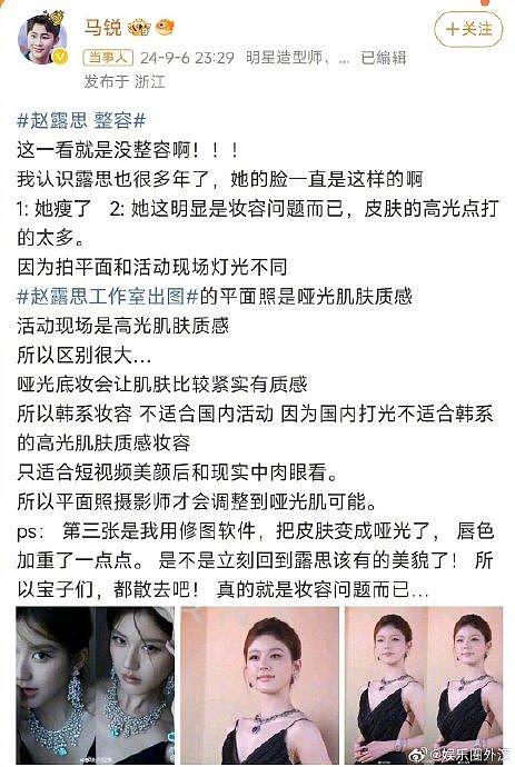 马锐为赵露思发声辟谣赵露思整容 还专门录视频解释是高光的问题 你怎么看？ - 1