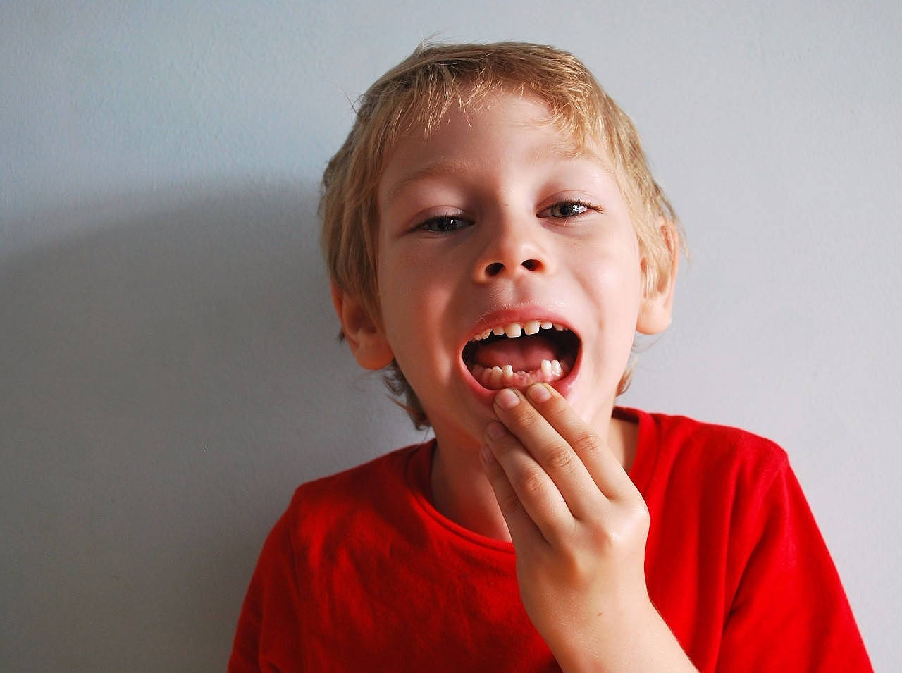 不长牙、鲨鱼齿、双排牙……孩子换牙期不注意这些问题，很容易中招 - 4