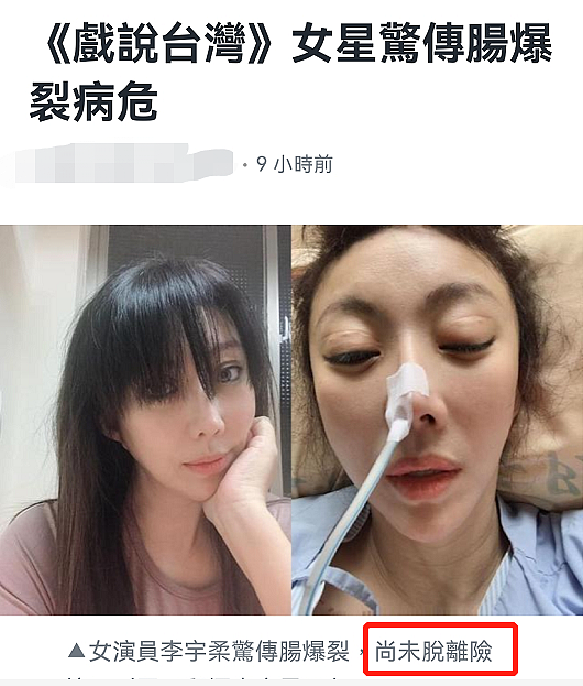 49岁李宇柔将二次开刀，因肠爆裂住进ICU，老公拒签放弃治疗书 - 3