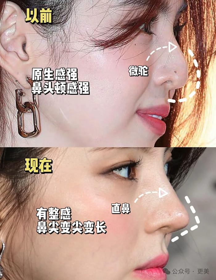 韩素希割双眼皮前，就是典型的韩式肿眼泡啊… - 44