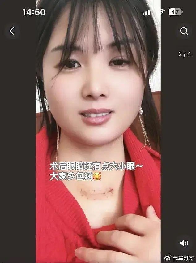 网红“一笑倾城”：拥有甜美笑容收获千万粉丝，如今怎样了？ - 6