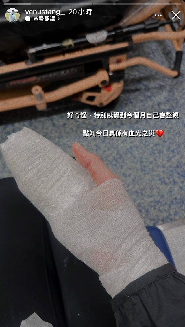 28岁港星邓美欣被狗咬伤，做4次手术才出院，还因此丧失拍剧机会 - 6