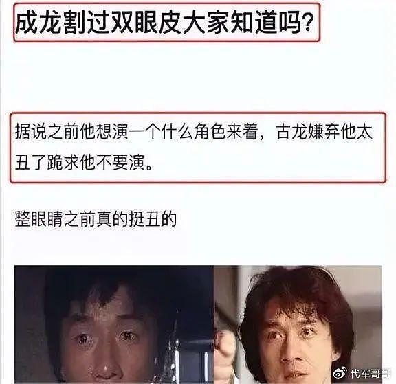 5位靠“整容翻身”的男星，个个事业一飞冲天，看看都有谁？ - 4