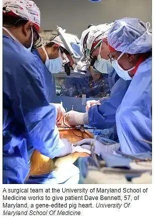 全球首个接受猪心脏移植病患死亡 手术后两个月去世死亡原因未明确 - 4
