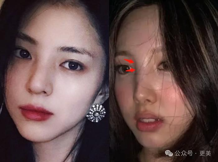韩素希割双眼皮前，就是典型的韩式肿眼泡啊… - 36