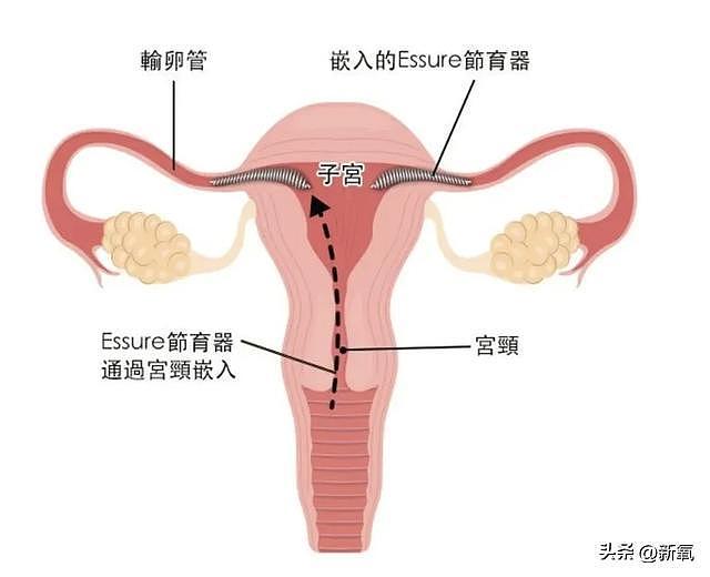 本以为他俩是形婚，结果现在孩子都要生出来了？ - 8