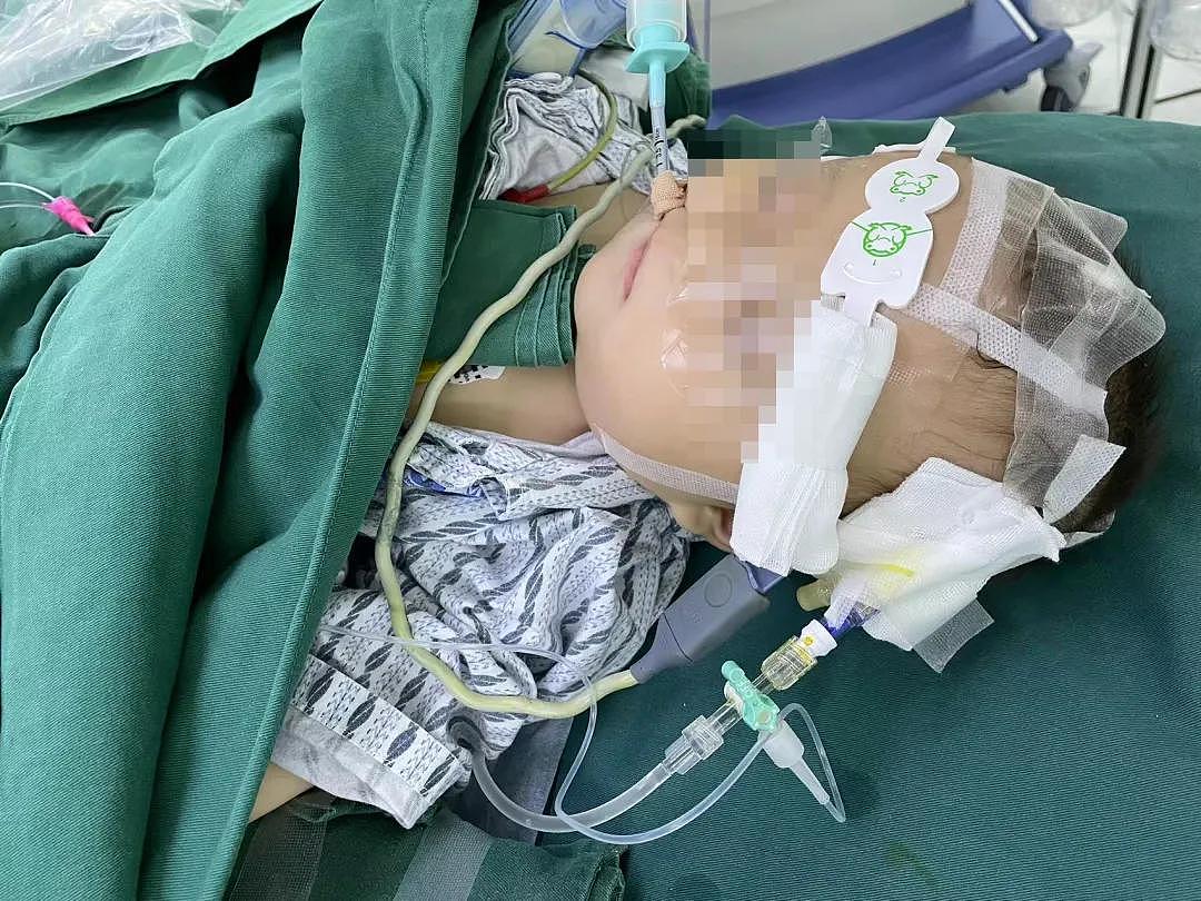 狐大医｜7月龄宝宝脑袋长葫芦状瘤，3小时手术后重获新生 - 8