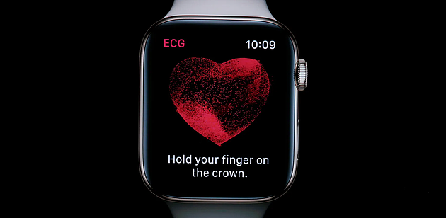 研究显示，苹果Apple Watch可帮助发现另一种危及生命的心脏疾病 - 1