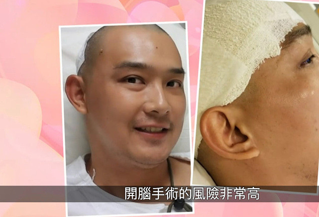 TVB配角刘家聪曾患脑瘤经历过半身瘫痪 能够再次回到幕前让人感动 - 6