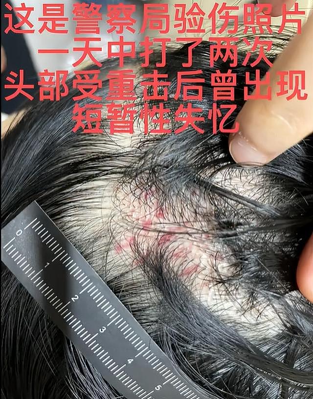 演员王东家暴视频曝光，掐妻子脖子用木板殴打，本人发文道歉 - 10