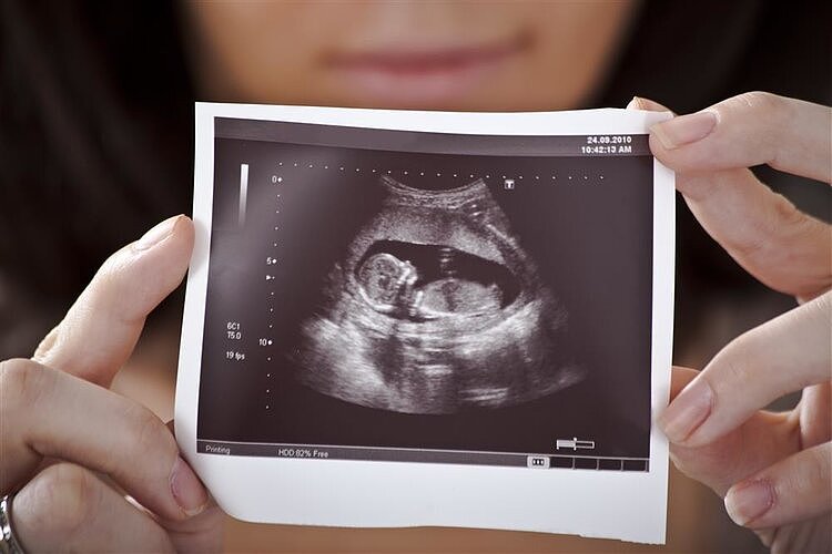 胚胎停育都是有前兆的，如果有这些症状要及时就医，保胎还来得及 - 3